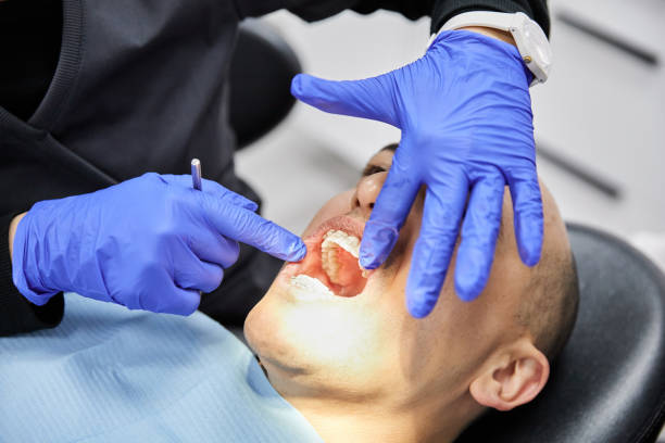 Best Emergency Dental Care for Broken or Chipped Teeth in Jennings, MO